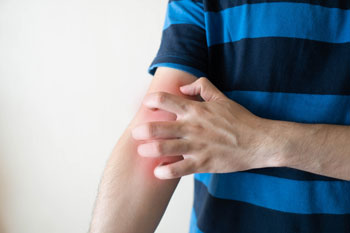 man-scratching-arm-having-itching-redness man-scratching-arm-having-itching-redness