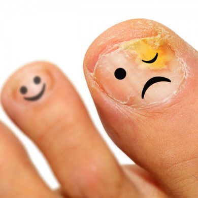 Urskive svært hjælp Din guide til effektiv behandling af gule negle | ShytoBuy