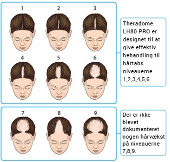 theradome-hairloss theradome-hairloss