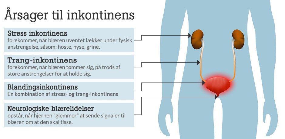 typer-af-inkontinens